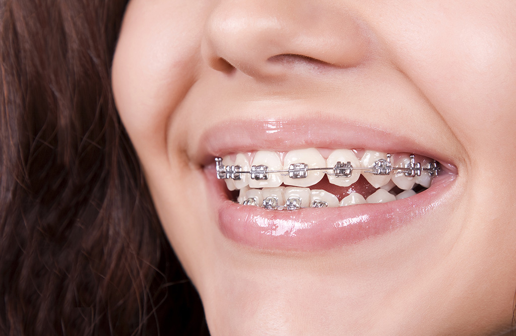 orthodontic-treatment-img