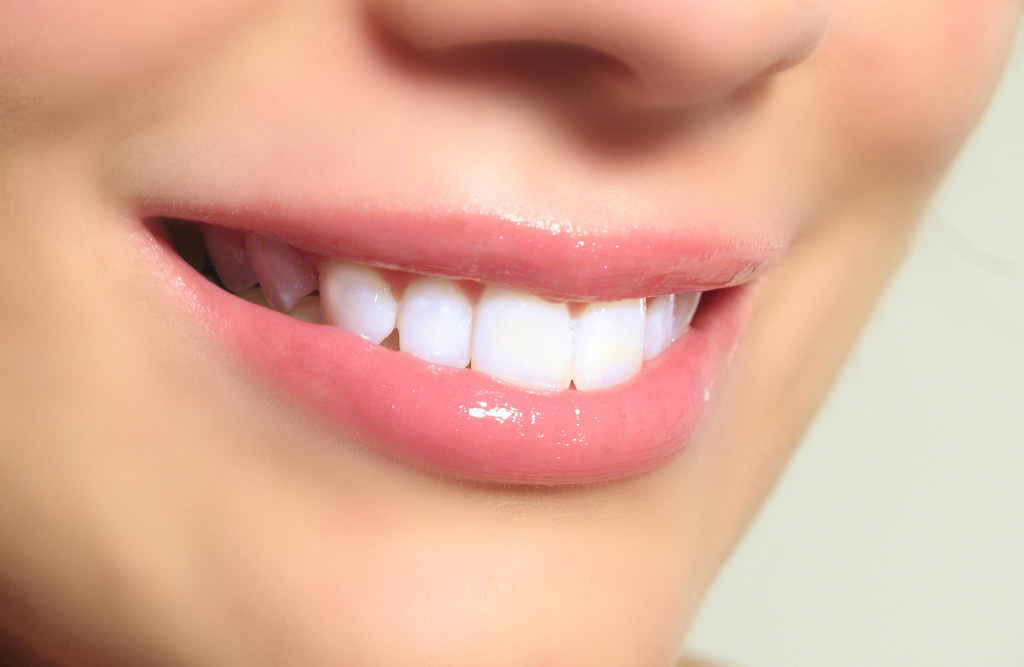 teeth-whitening-img